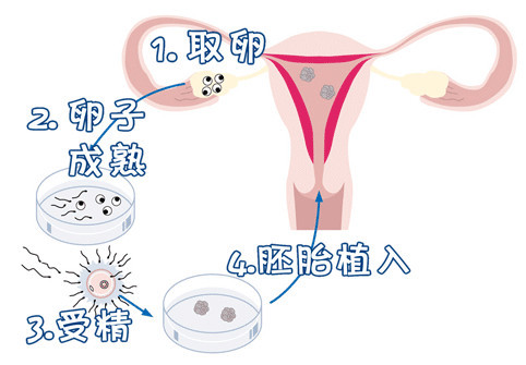 供卵代生网生殖中心